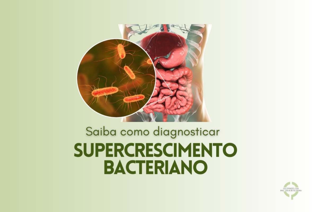 Como Diagnosticar o Supercrescimento Bacteriano no Intestino Delgado?