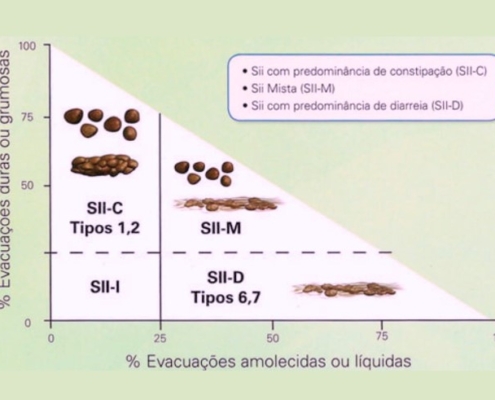 Síndrome do Intestino Irritável: Compreendendo os Sintomas e as Classificações