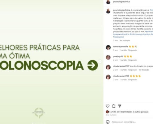 Melhores Práticas para uma Ótima Colonoscopia