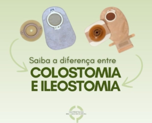 Saiba a Diferença entre Colostomia e Ileostomia