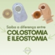 Saiba a Diferença entre Colostomia e Ileostomia