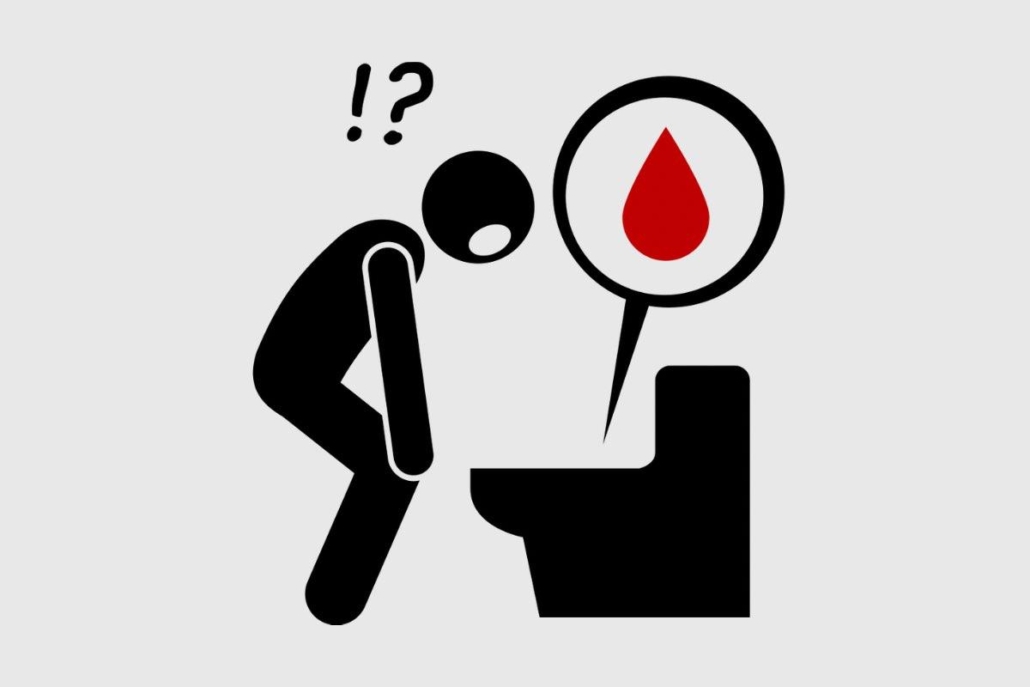 Sangramento nas fezes: quando é sinal de alerta?