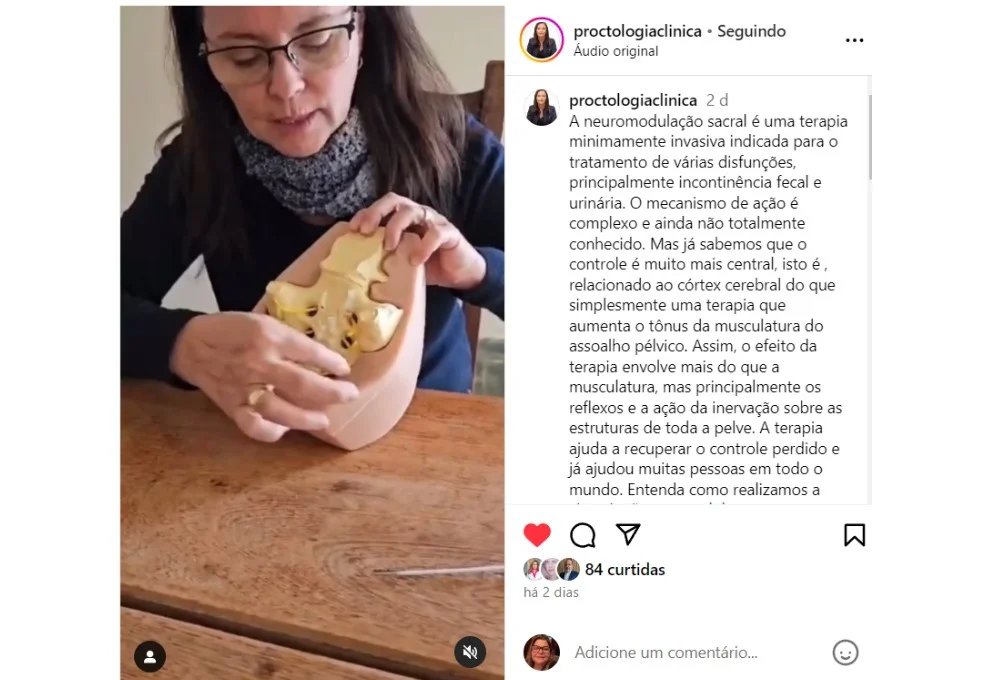 Dra. Lucia de Oliveira Explica o Funcionamento da Neuromodulação Sacral