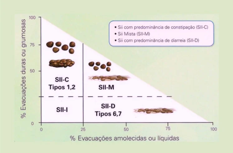 Síndrome do Intestino Irritável: Compreendendo os Sintomas e as Classificações